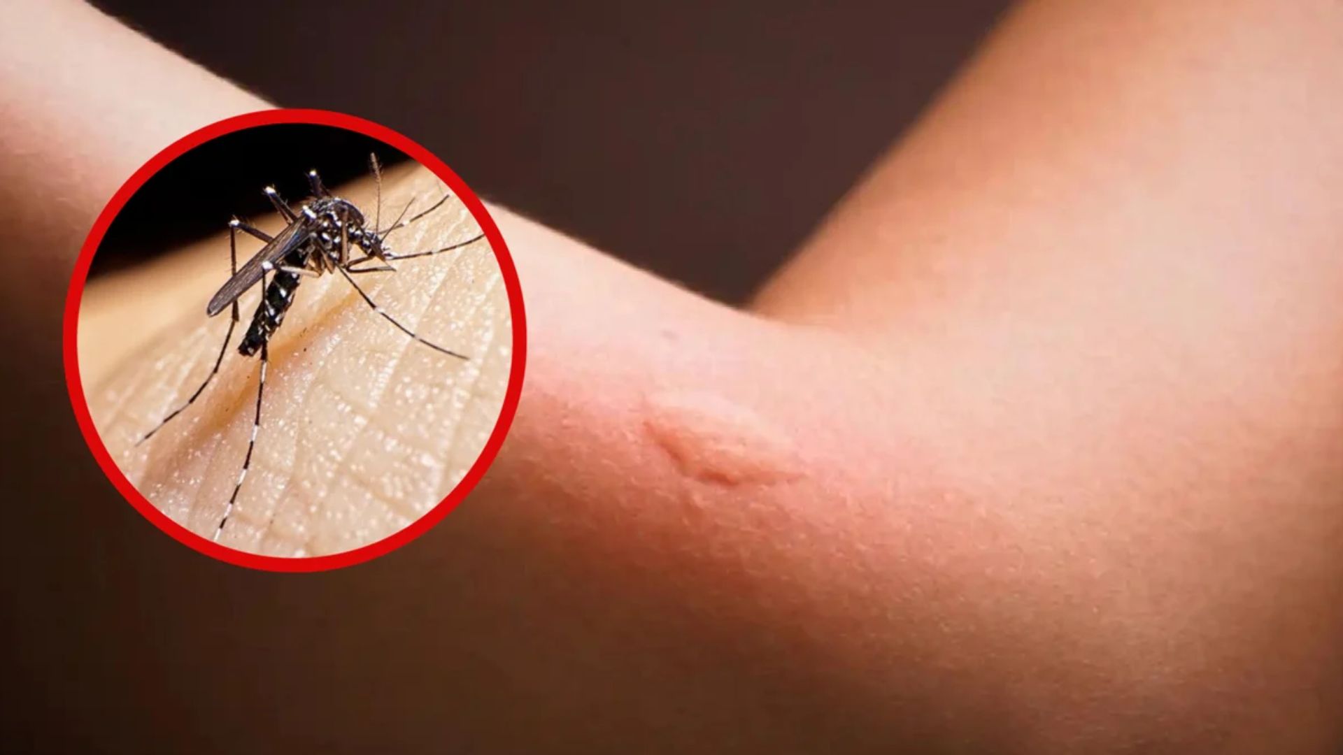 Aumentan los Casos de Dengue en Oaxaca: 56 Municipios Afectados