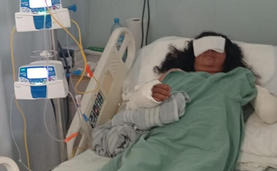 Maratonista oaxaqueña en riesgo de perder ambos brazos tras ataque de perros; exigen apoyo
